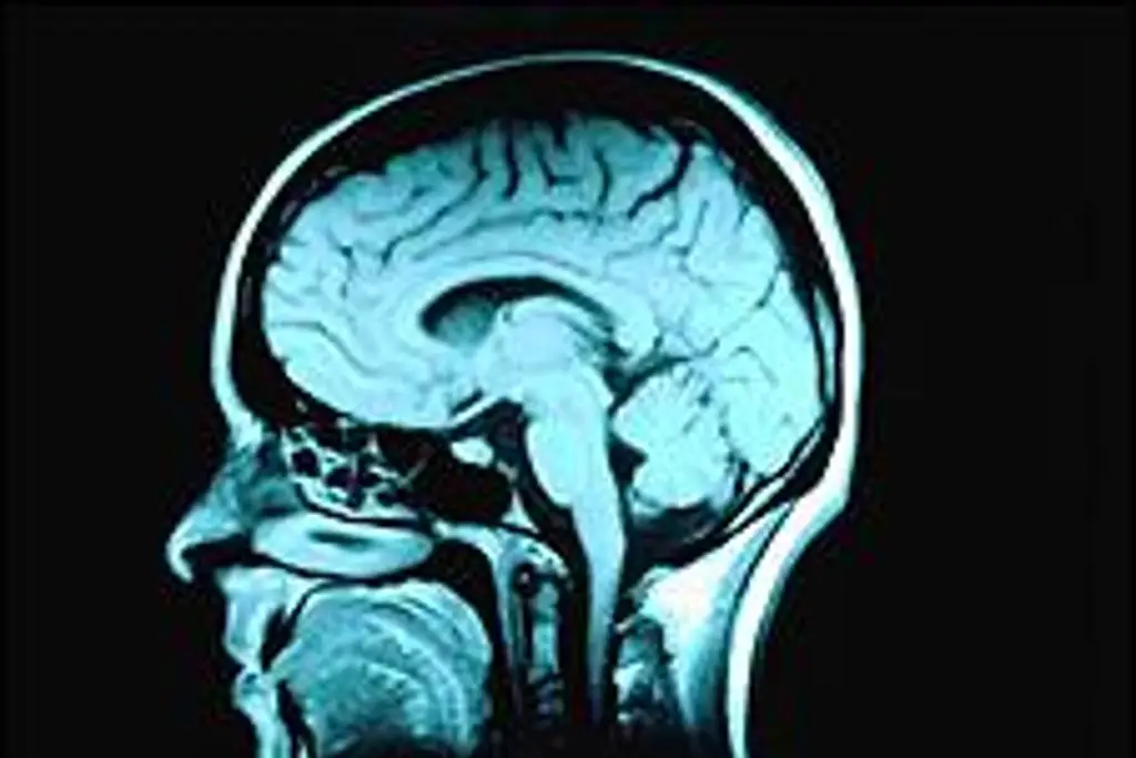 Imagen Usan a Pink Floyd para medir cómo 'afecta la música al cerebro'