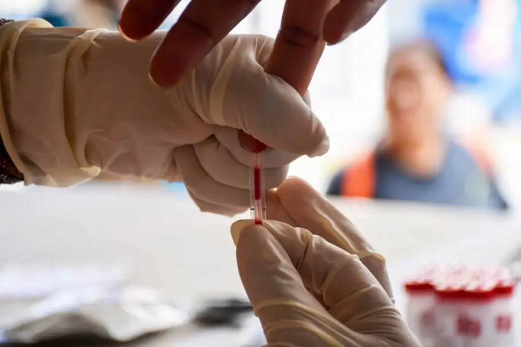 Imagen Reportan en 2023 más de 1 mil 200 nuevos casos de VIH en Veracruz