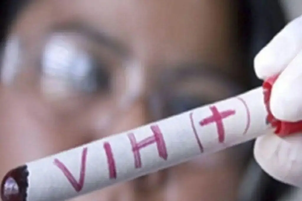 Imagen Se registran hasta 35 casos de VIH al mes en Veracruz