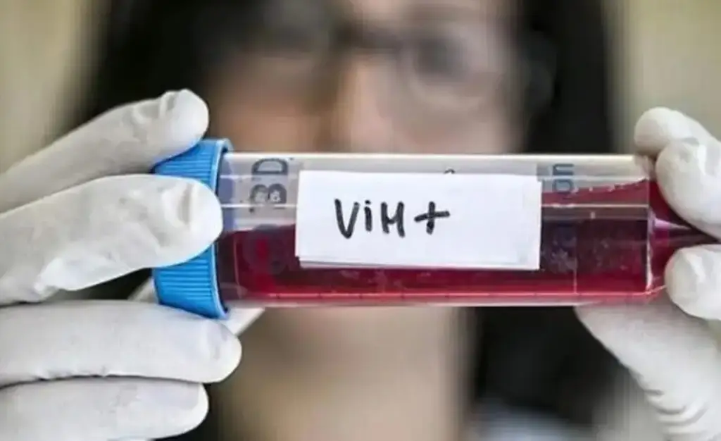 Imagen ¿Cómo evitar contagiarse de VIH-Sida? Esto dice Cruz Roja  
