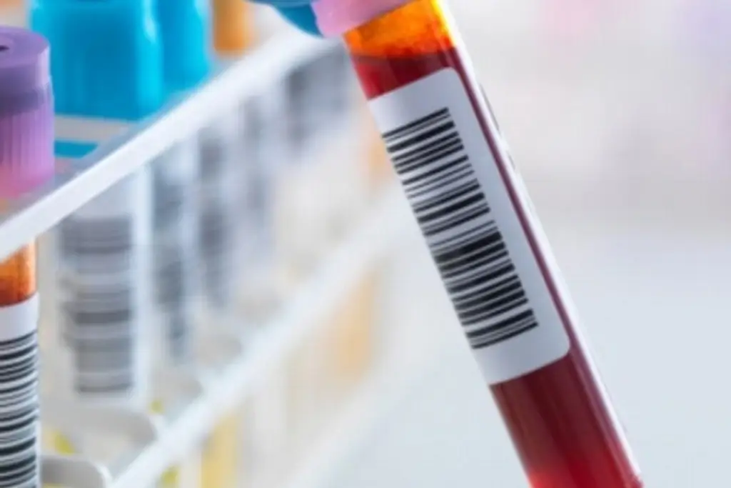 Imagen Científicos señalan que analizar proteínas en la sangre permite predecir qué órganos fallarán