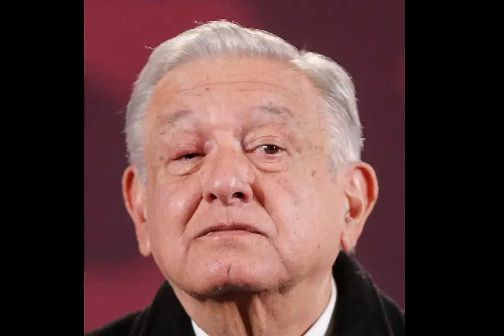 Imagen AMLO sufre infección en el ojo