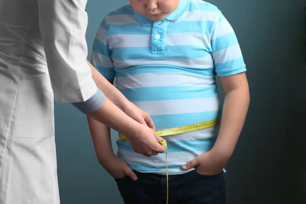 Imagen Obesidad en niños y adolescentes se incrementó cuatro veces en 30 años en el mundo, alerta OMS