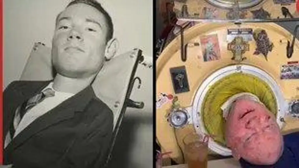 Imagen Fallece Paul Alexander, 'el hombre del pulmón de acero', a los 78 años 