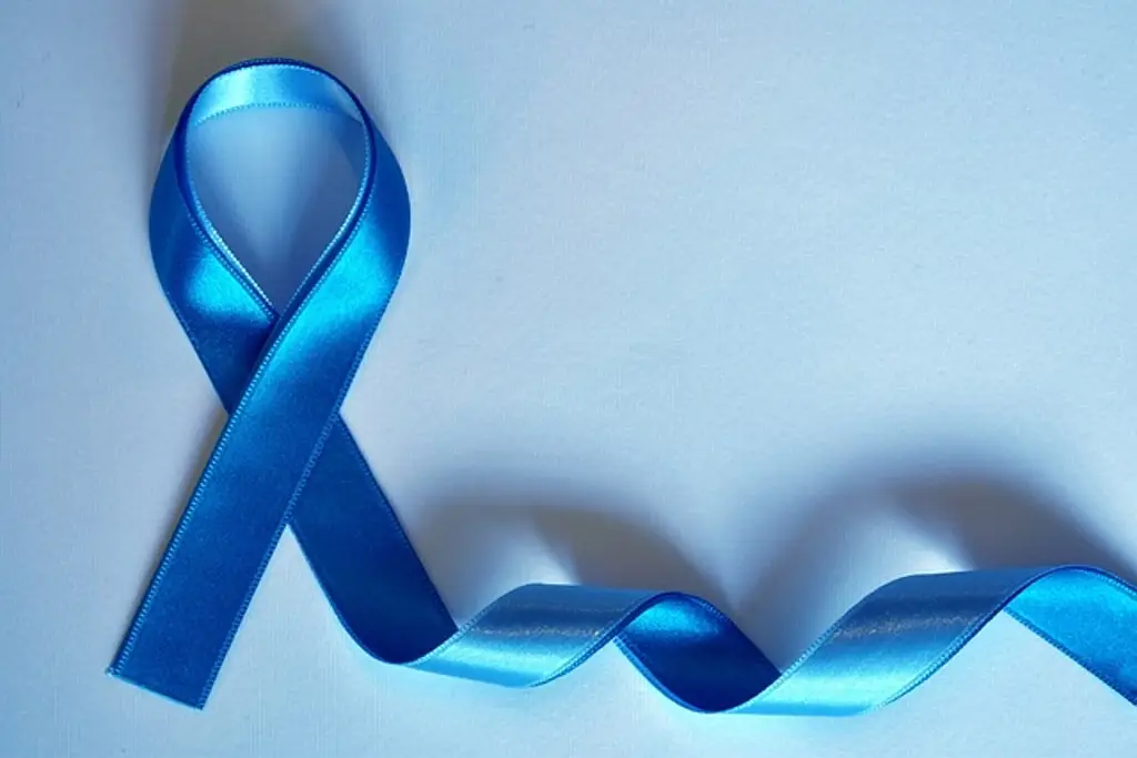 Imagen Casos de cáncer de próstata se duplicarán en 2040 y muertes crecerán el 85%, según The Lancet