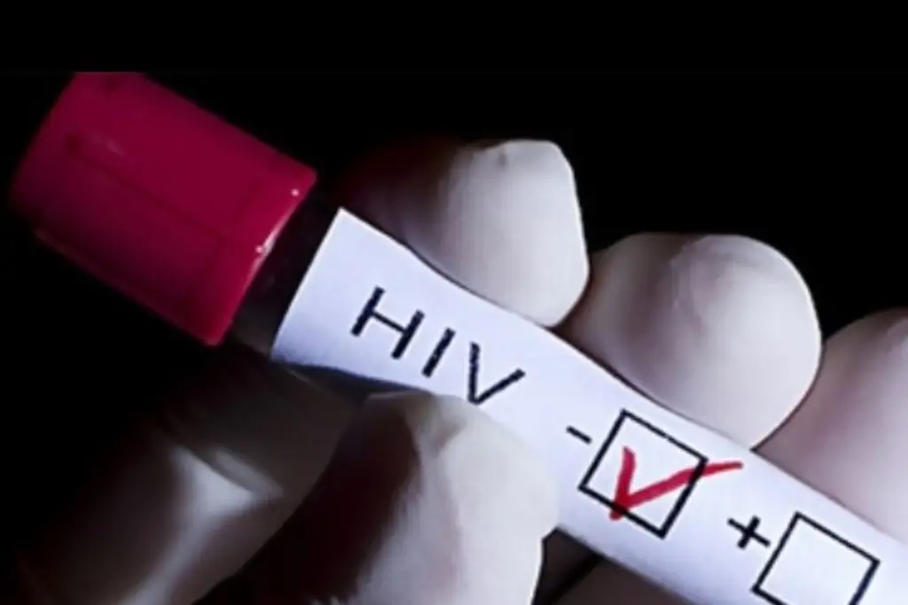 Imagen Veracruz acumula más de 34 mil casos de VIH-sida