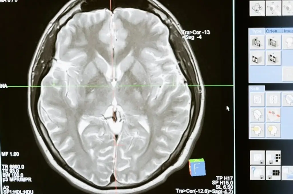 Imagen Descubren que unas células no neuronales también procesan la memoria