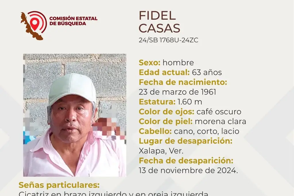 Imagen Hombre de la tercera edad desaparece en Xalapa, Veracruz 