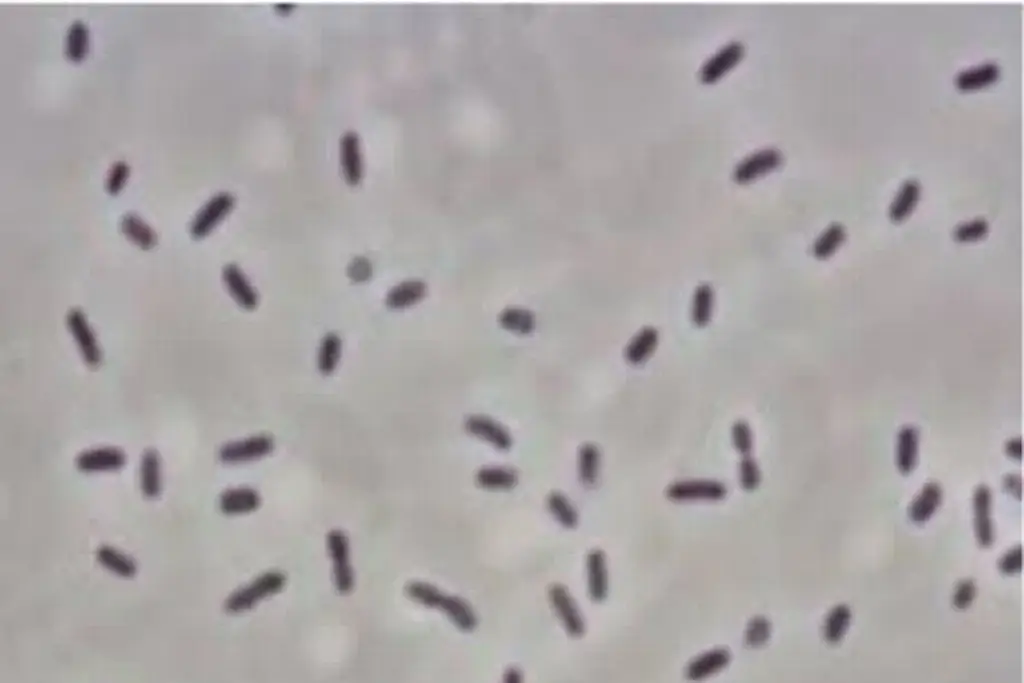 Imagen Emiten alerta epidemiológica por brote de bacteria Klebsiella oxytoca en Edomex