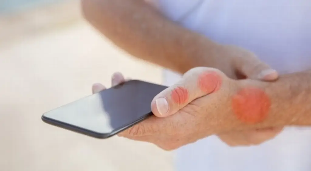 Imagen Piden moderar el uso de tu teléfono celular para evitar tendinitis