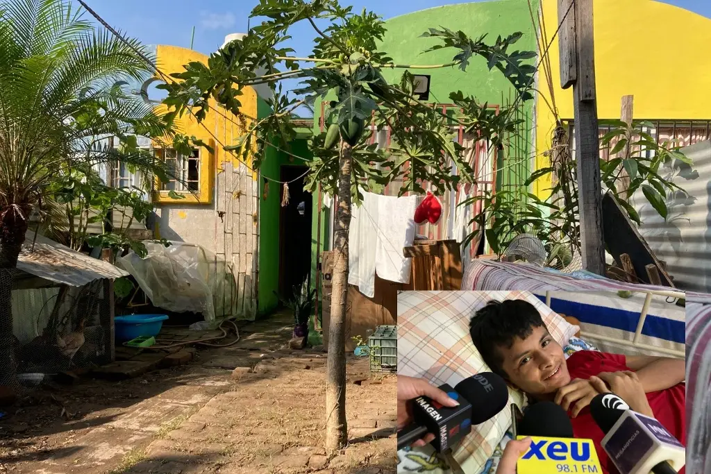 Imagen Ampliarán casa de Brandon: el chico que perdió la pierna en accidente en la Veracruz-Cardel