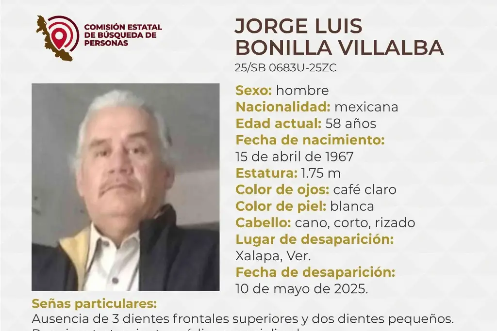 Imagen Hombre desaparece en Xalapa, Veracruz; estas son sus características 