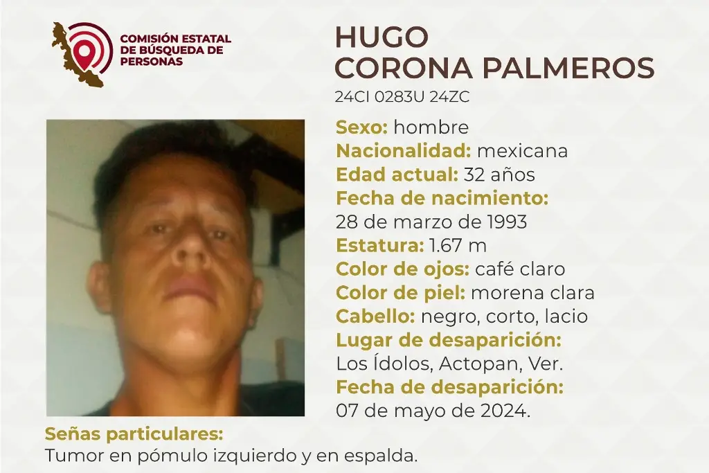 Imagen Piden apoyo para localizar a hombre desaparecido en Actopan, Veracruz; tiene un tumor