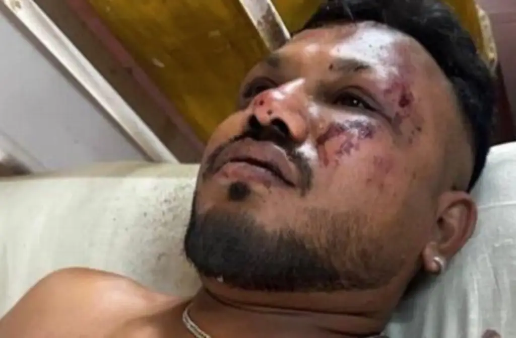 Imagen Él es el único sobreviviente del accidente del avión de Air India (+Video)