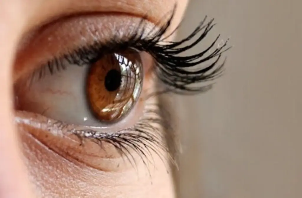Imagen ¿Qué es el queratocono? La enfermedad ocular por la que puedes perder la visión  