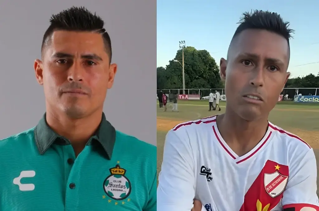 Imagen ¿Qué es la esclerodermia, enfermedad que le cambió el rostro a Osvaldo Martínez?