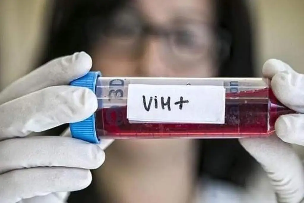Imagen ¿Cómo evitar que un bebé nazca con VIH/SIDA si la madre tiene el virus? Esto dijo médico