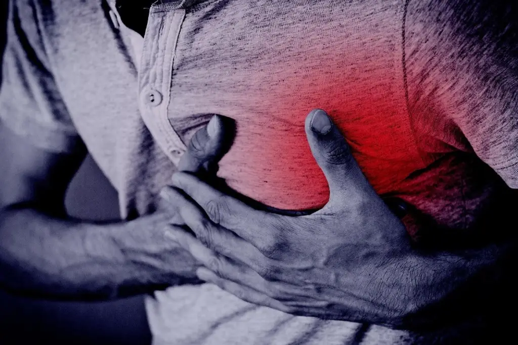 Imagen ¿Qué hacer en caso de un infarto?