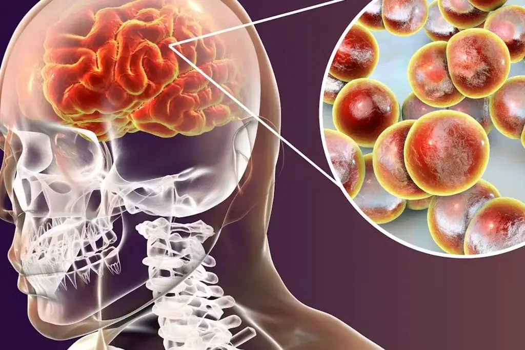 Imagen Desarrollan prueba molecular que diagnostica meningitis en una hora; ya se usa en México