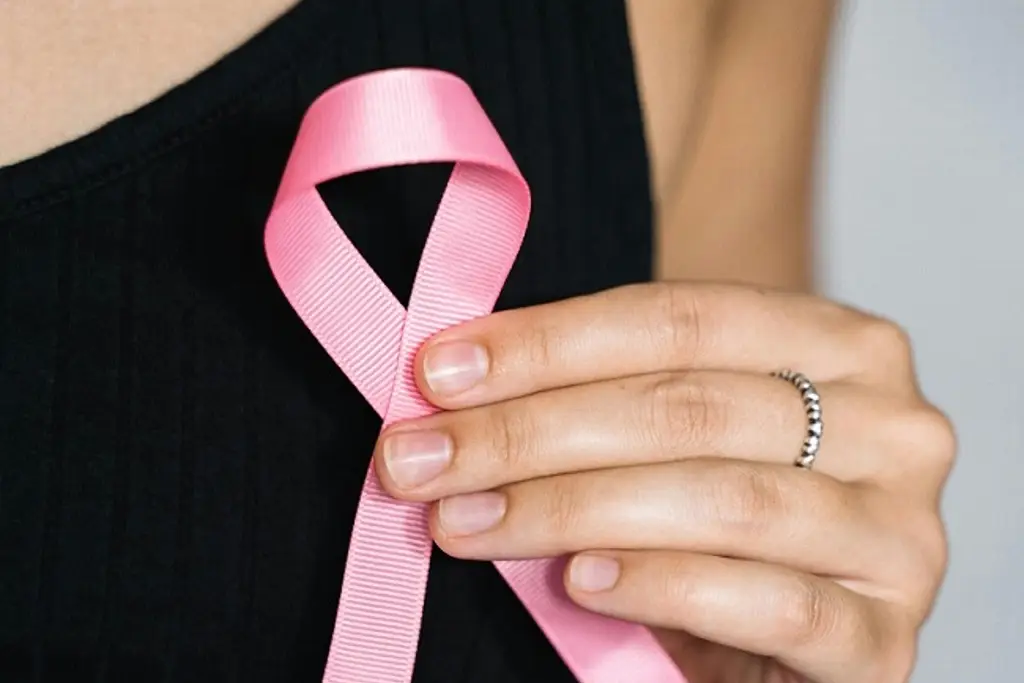 Imagen Detectan caso de cáncer de mama en etapa avanzada en joven de 18 años, piden a mujeres estar alertas 