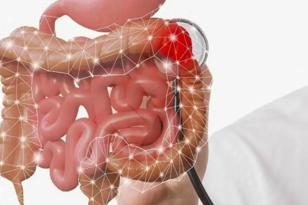Imagen Estudio detecta cáncer colorrectal mediante bacterias presentes en el intestino