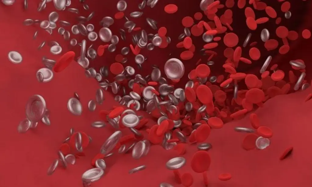 La trombosis puede ser mortal ¿Qué la provoca y cómo identificarla a tiempo?