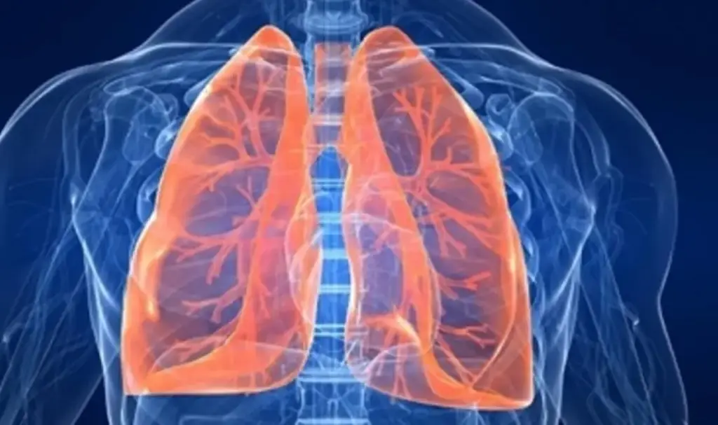 Imagen Esto es todo lo que debes de saber acerca de la neumonía 