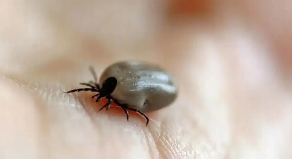 Imagen ¿Por qué las garrapatas pueden generar alergias? Esto dice experto 