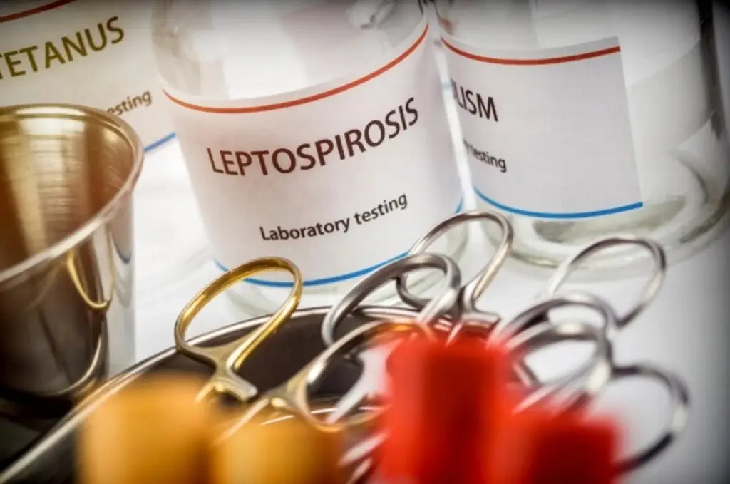 Imagen ¿Qué es la leptospirosis, qué la causa y cuáles son sus síntomas? 