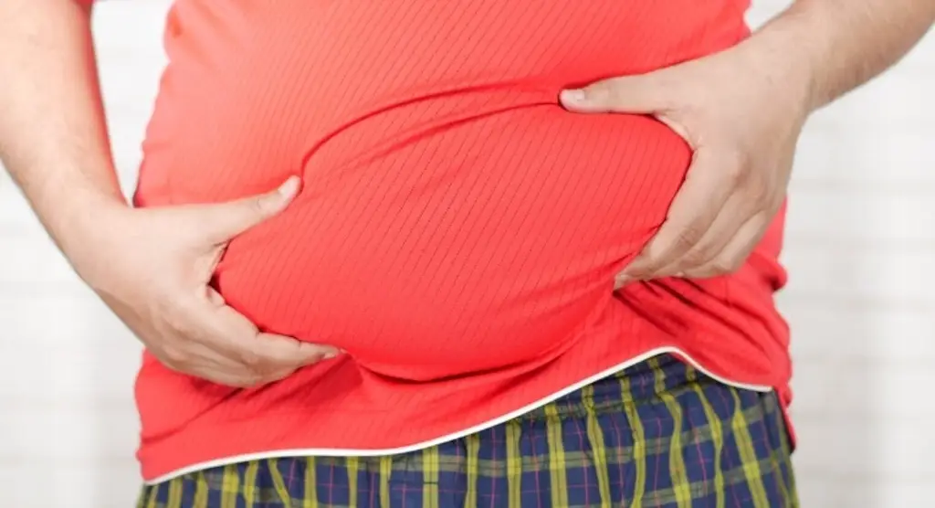 Imagen Una variante genética podría predisponer a la obesidad temprana en adultos jóvenes: Estudio