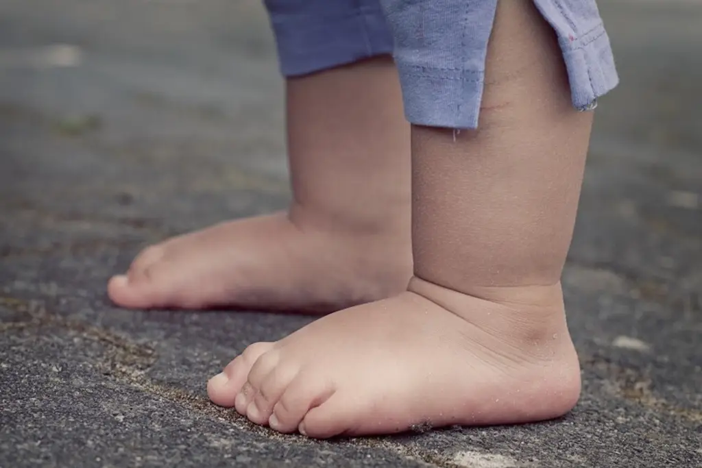 Imagen Veracruz, entre los primeros lugares con casos de obesidad infantil a nivel nacional