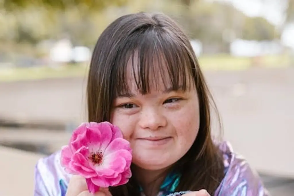 Imagen Habrá rodada por el día del Síndrome de Down en Boca del Río 