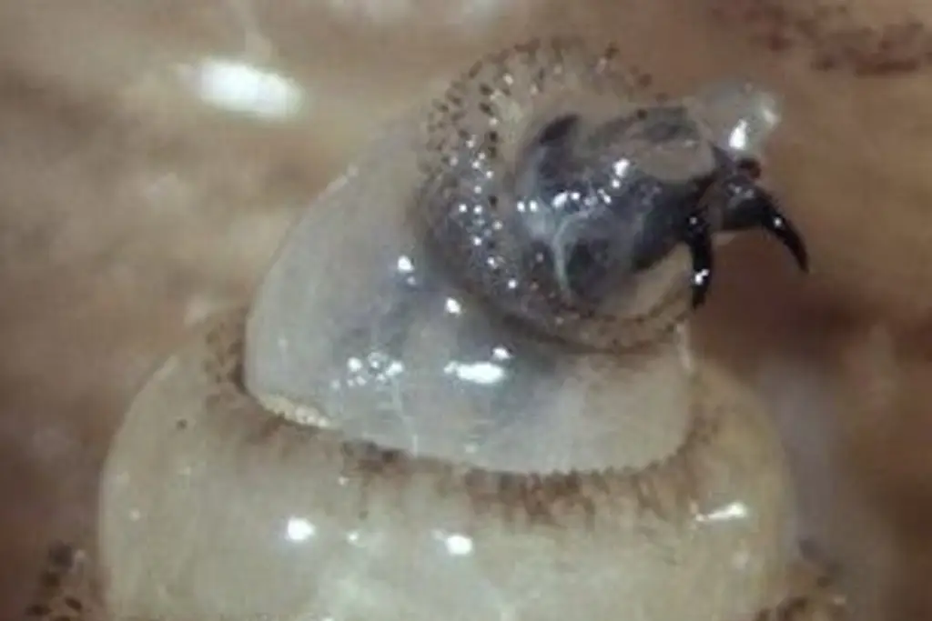 Imagen Acumulan siete casos de miasis humana por gusano barrenador en Tabasco