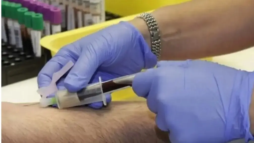 Imagen Un nuevo método avanza hacia la detección del cáncer con un análisis de sangre, según estudio