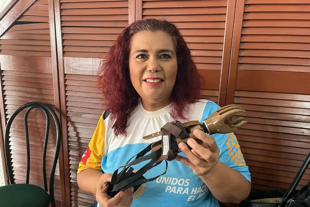 Imagen Donarán prótesis de manos mecánicas en Veracruz