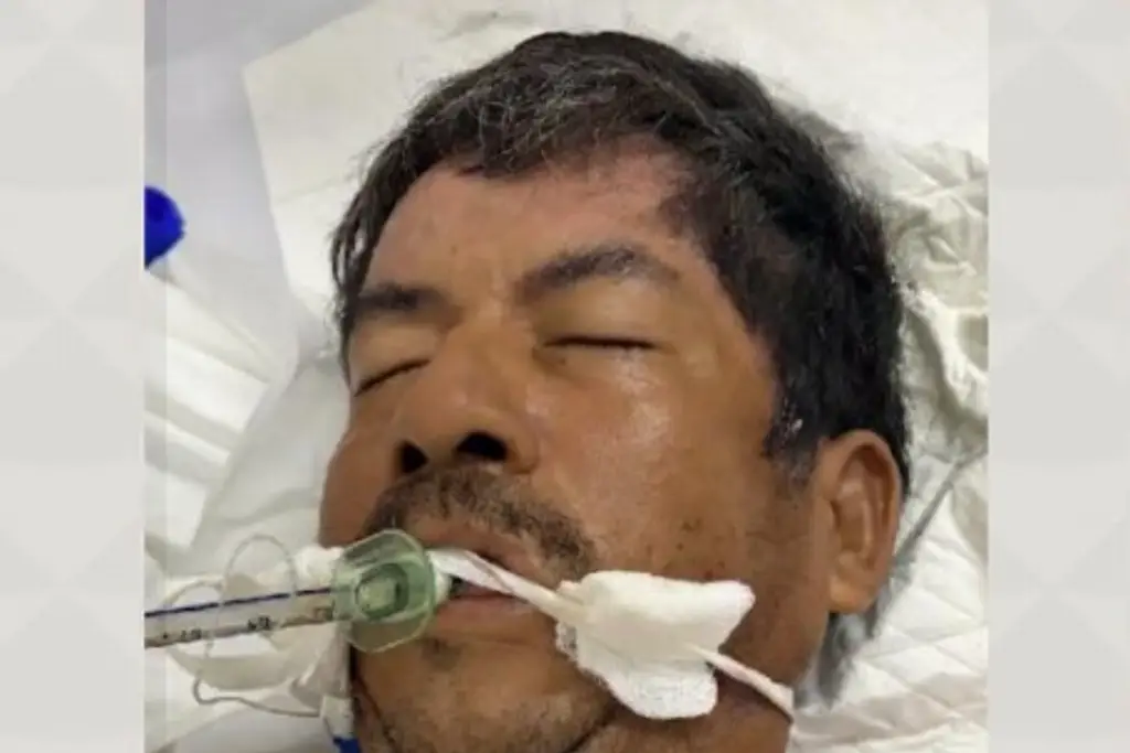 Imagen Está hospitalizado en Boca del Río. Buscan a su familia