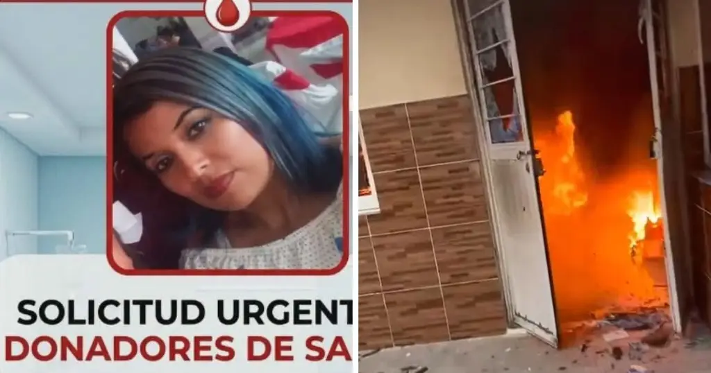 Imagen Piden donadores de sangre para joven lesionada en explosión en Banderilla