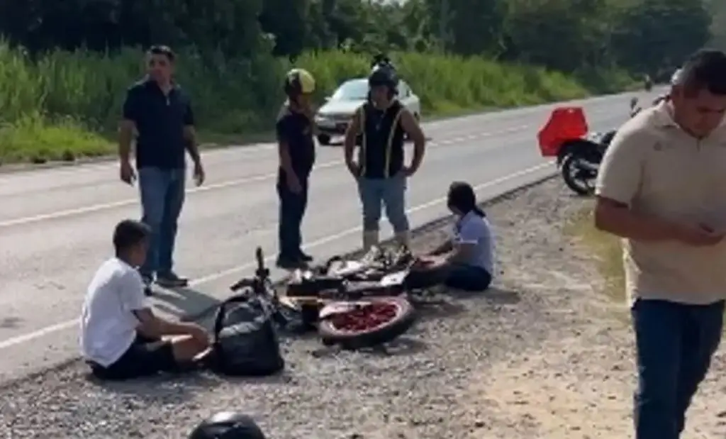 Imagen Joven que perdió la cara en accidente de moto muestra el resultado de recuperación
