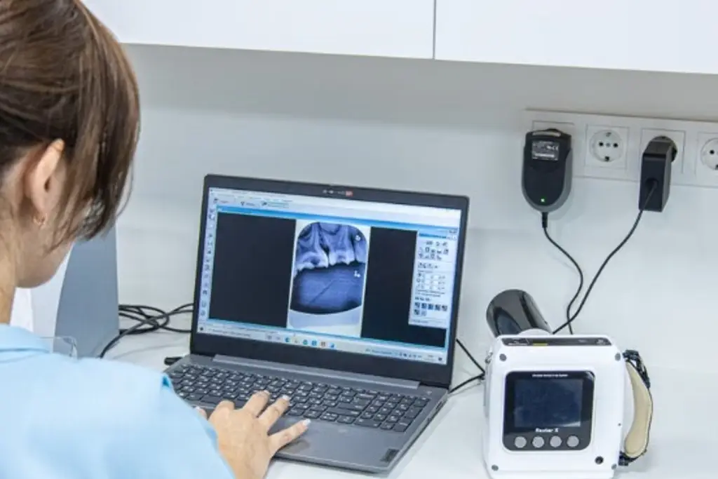 Imagen ¿Mastografía o ultrasonido? La importancia de elegir el estudio adecuado contra el cáncer de mama