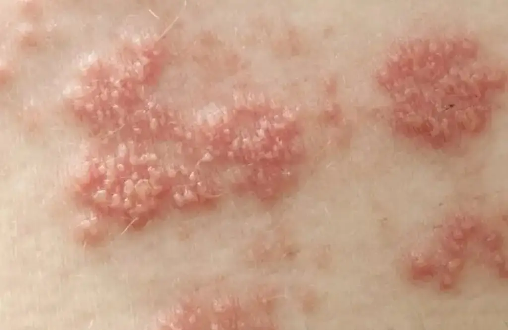 Destacadas