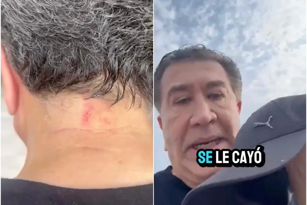 Imagen Casi 60 mil pesos le dieron a ladrón por la cadena de Héctor Yunes; esto pasó con el caso