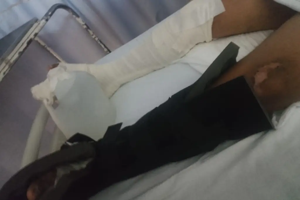 Imagen Se accidenta en moto y sigue esperando la cirugía en Veracruz (Video)