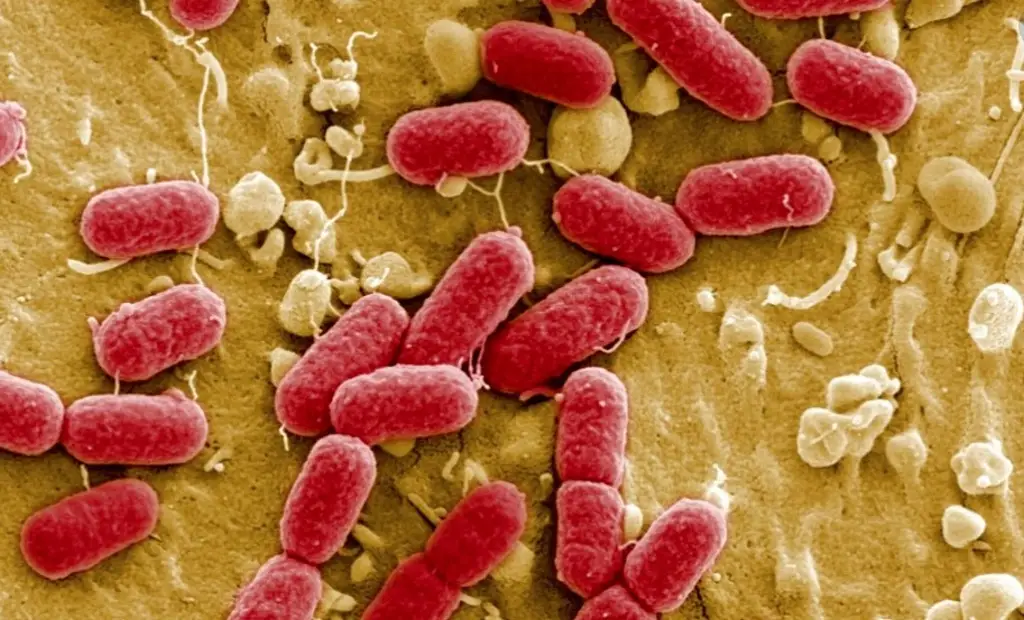 Imagen Exigimos que no se nos intoxique: médicos afectados por brote de gastroenteritis 