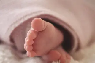 Imagen Bebé nace con cuatro brazos y piernas; creen que es 