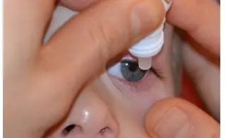 Imagen Pierde un ojo por usar gotas 'contaminadas'