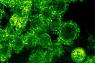 Imagen ¿Qué es el virus Nipah y cómo se transmite?