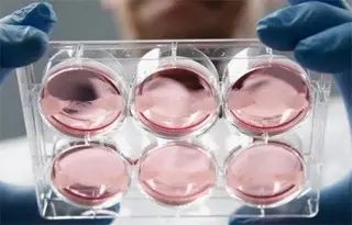 Imagen Un ensayo de terapia con células madre, prometedor contra esclerósis múltiple progresiva