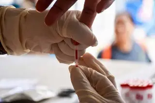 Imagen Reportan en 2023 más de 1 mil 200 nuevos casos de VIH en Veracruz