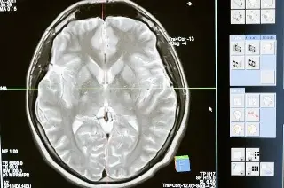 Imagen Identifican área del cerebro que responde a las amenazas, según un estudio