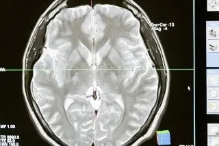 Imagen Descubren que cerebros de hombres y mujeres se organizan de forma diferente 